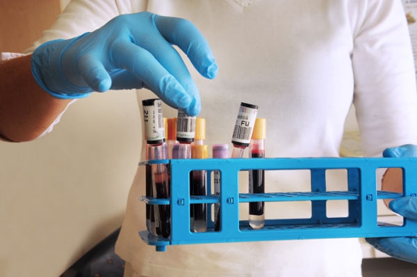 Antifosfolipidový syndrom z pohledu klinického hematologa